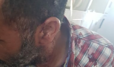 المدير الإقليمي للتعليم بفاس يدخل على خط واقعة الإعتداء على أستاذ بالمرجة