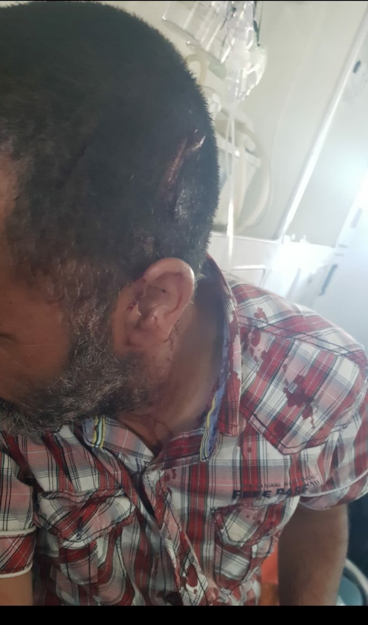 المدير الإقليمي للتعليم بفاس يدخل على خط واقعة الإعتداء على أستاذ بالمرجة